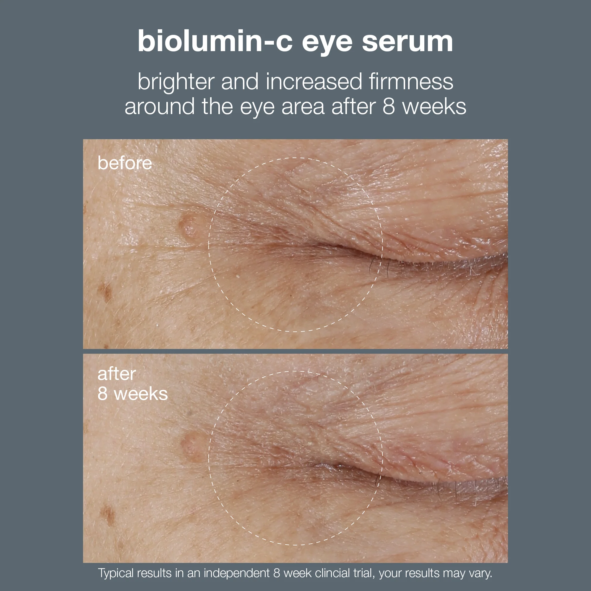 Biolumin-C Vitamin C Eye Serum - Image 5
