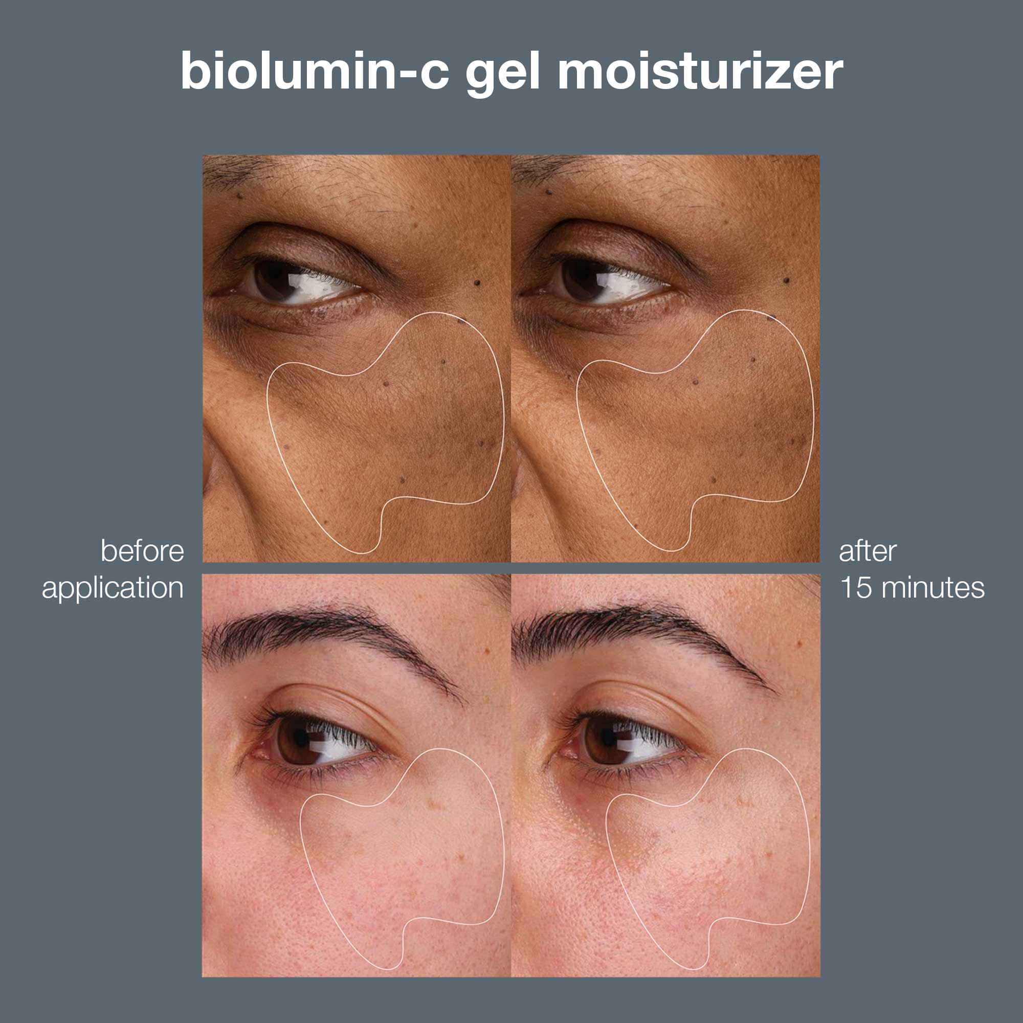 Biolumin-C Vitamin C Gel Moisturizer - Image 6