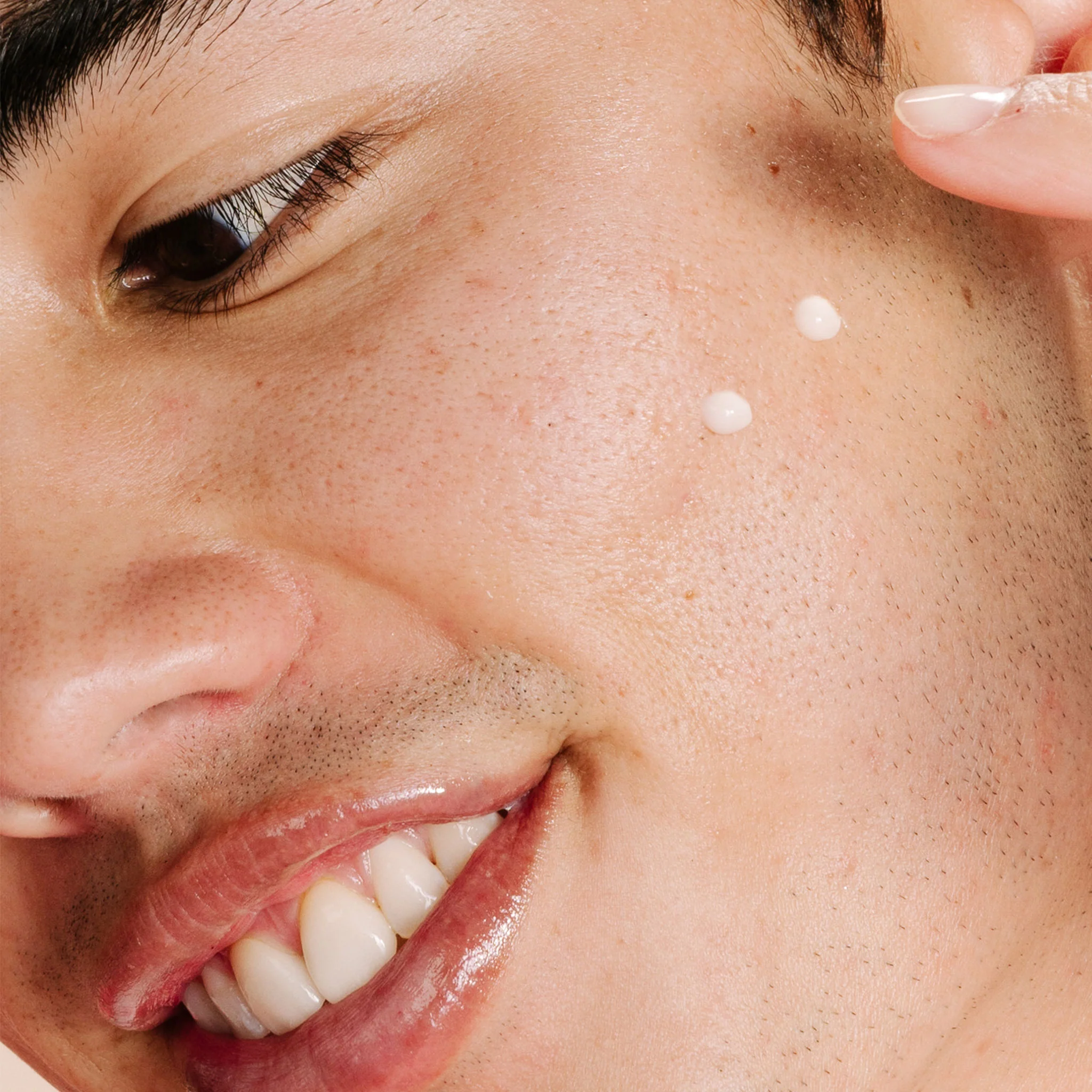 clear start breakout clearing kit - Image 5