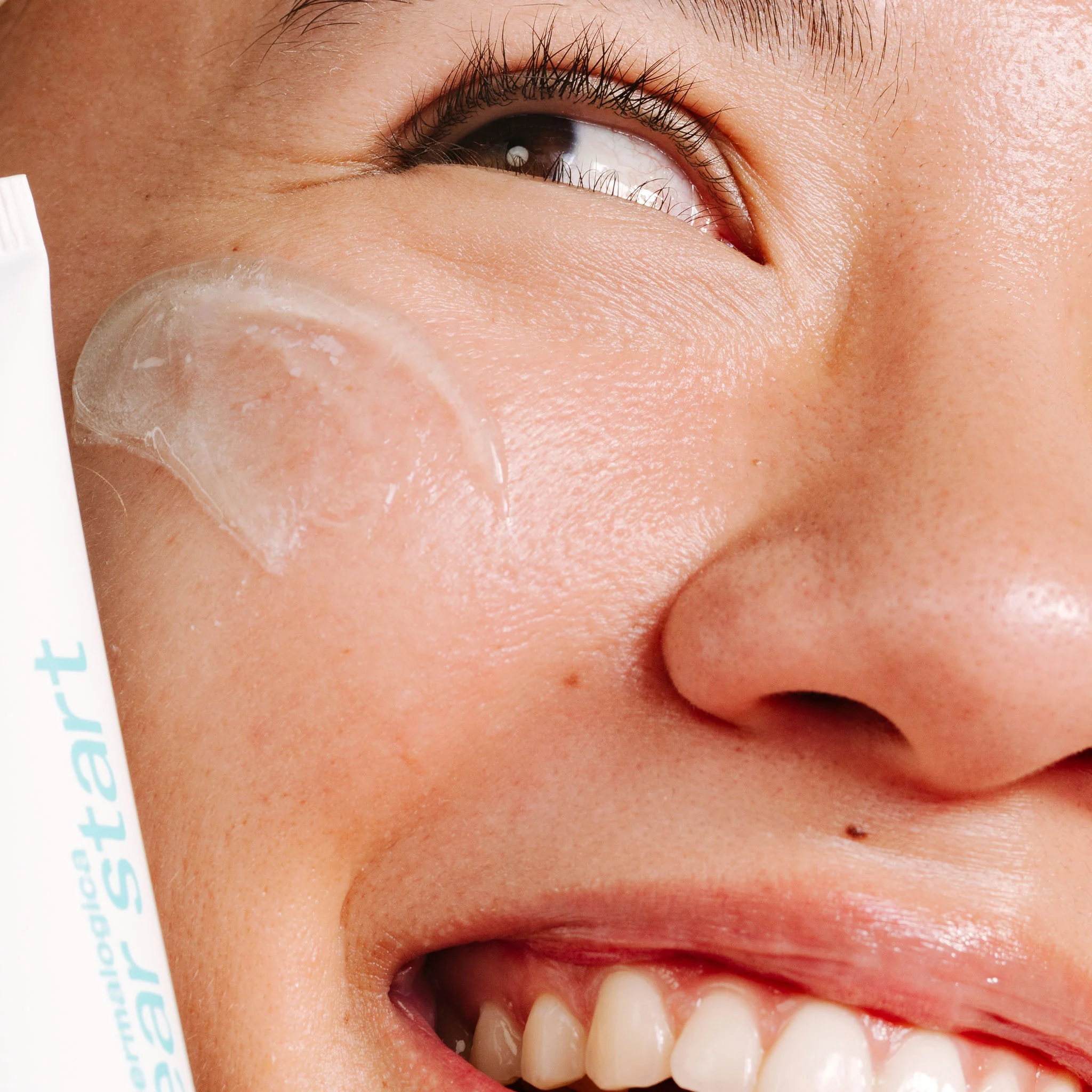 clear start breakout clearing kit - Image 6