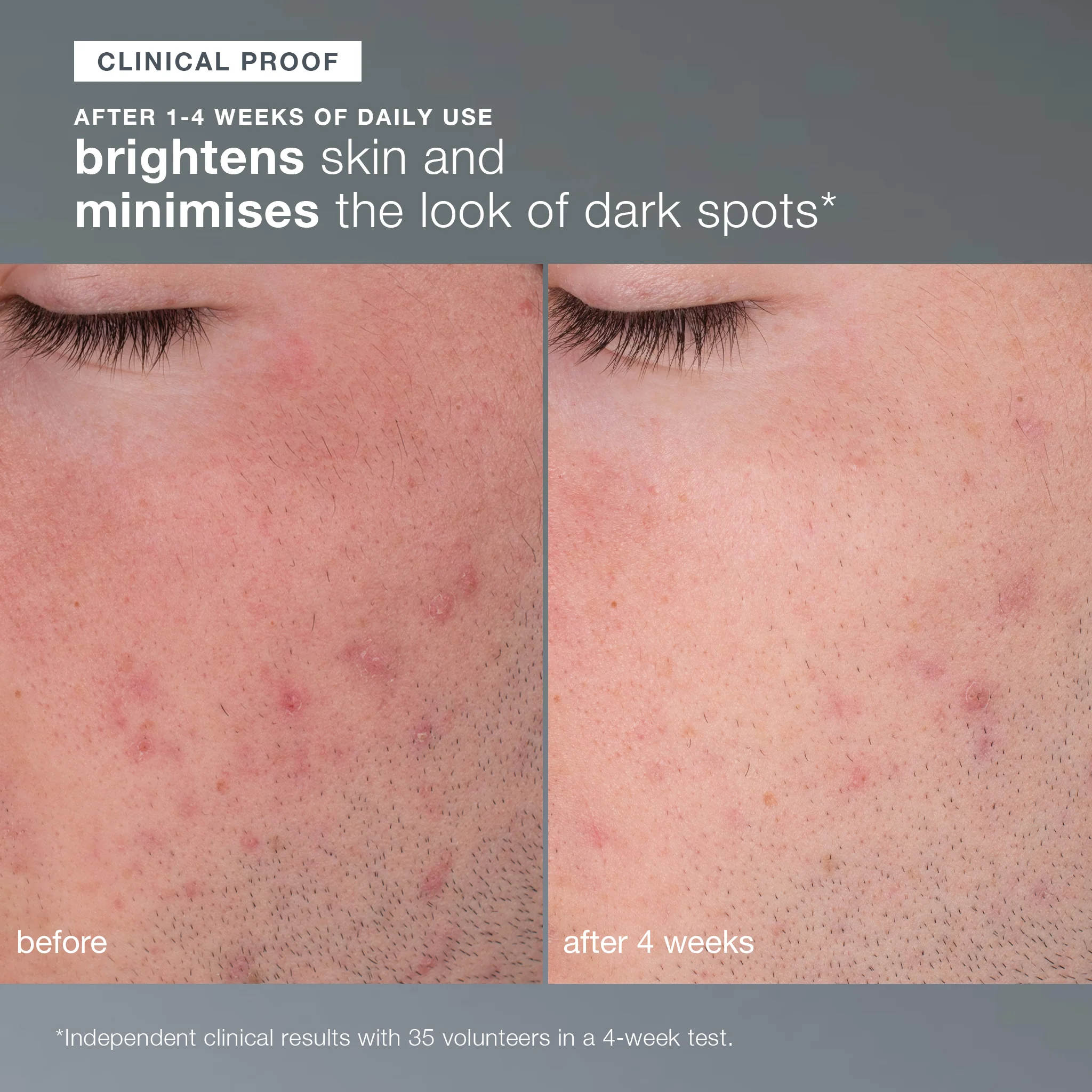 Daily Microfoliant Exfoliator - Image 7