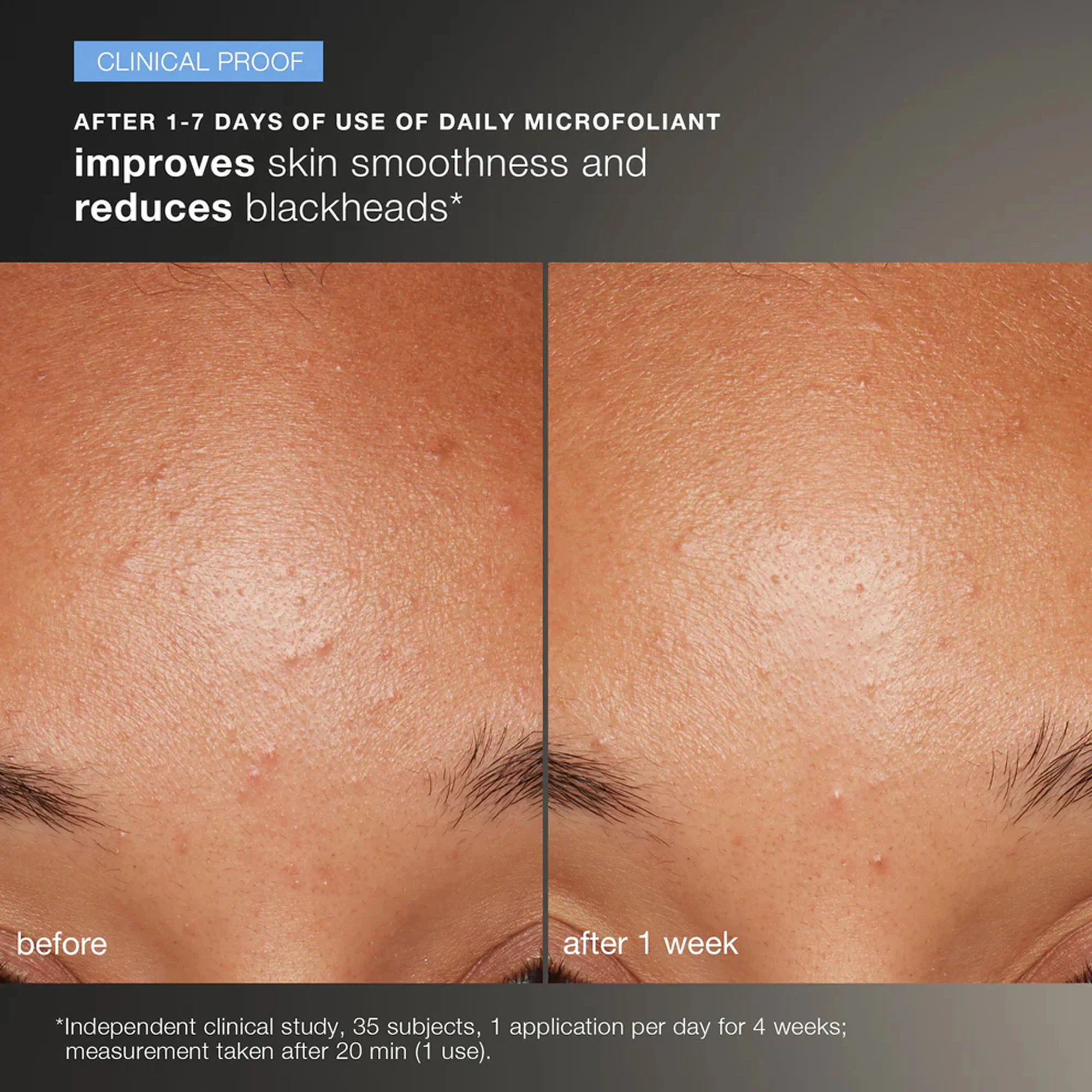 discover healthy skin kit - Image 4