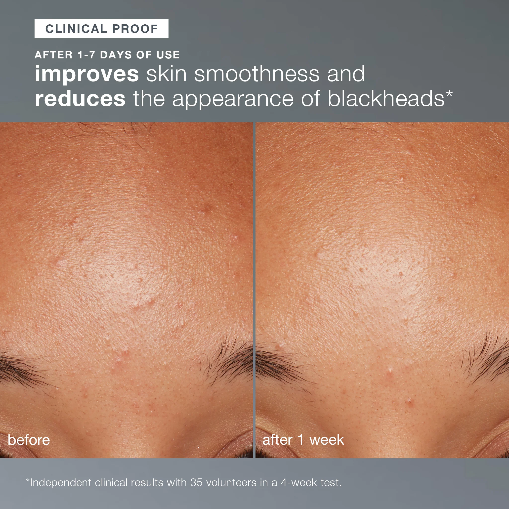 Daily Microfoliant Exfoliator - Image 8