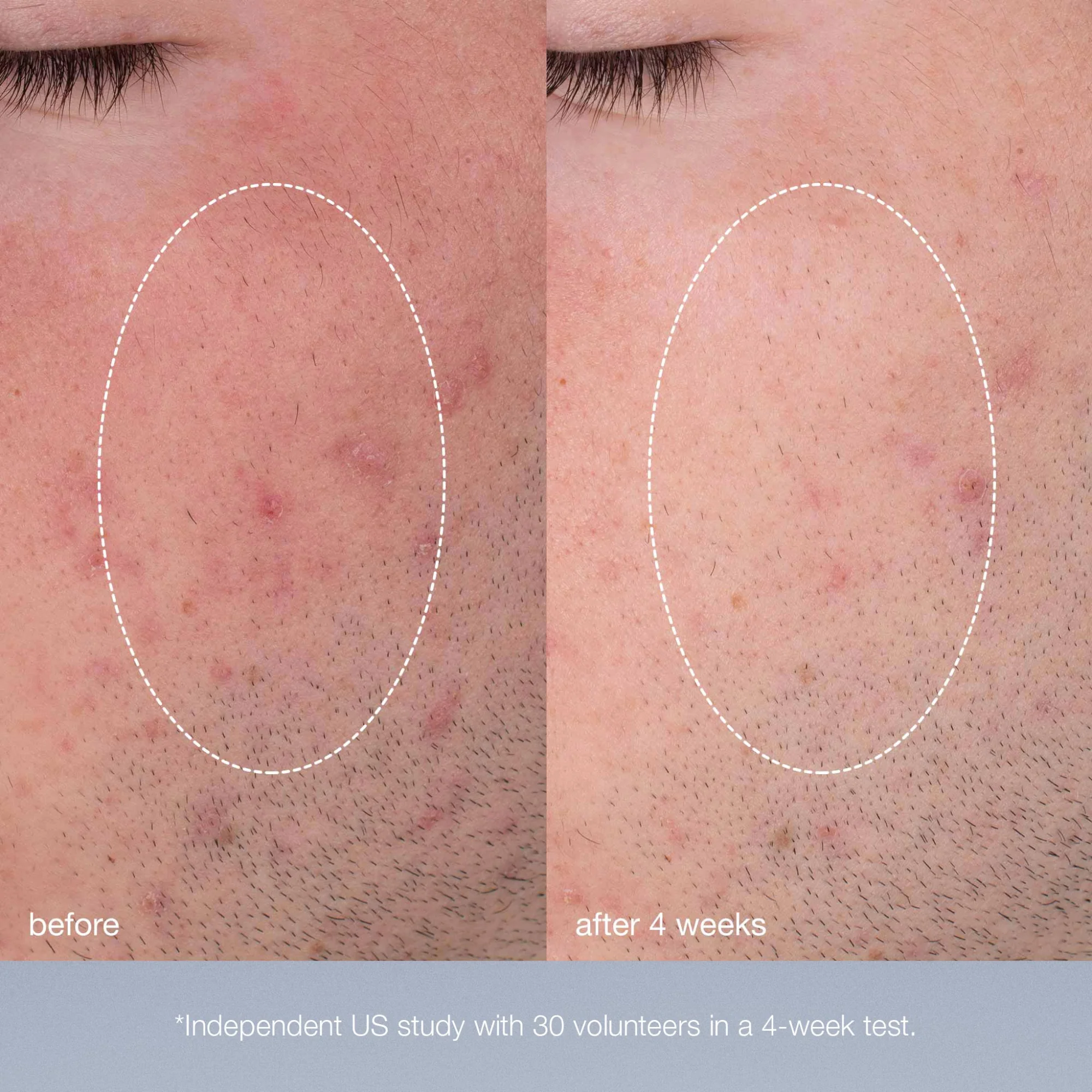 pro-collagen renewal trio - Image 8